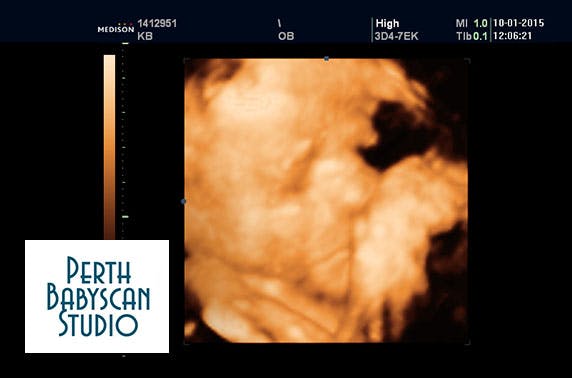 Baby Scan Studio Perth